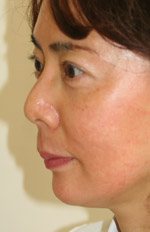 chin3.jpg