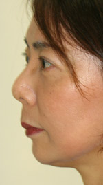 chin4.jpg