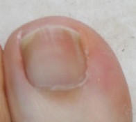 nail-l.jpg