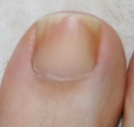 nail-r.jpg